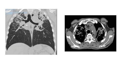 0525-101-AI-News-03-AI-powered-silicosis-test-Q&A_In-Article-2.png