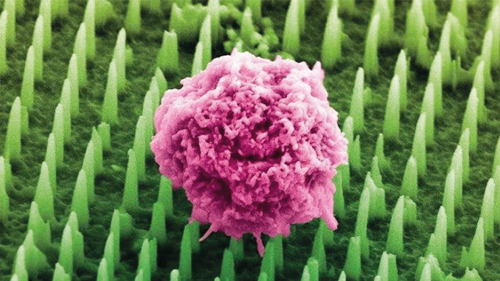 0625-101-AI-News-Tens-of-millions-of-nanoneedles-could-replace-painful-cancer-biopsies_Teaser.png