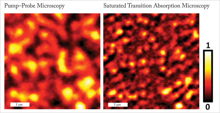 Image of Super Resolution Microscopy